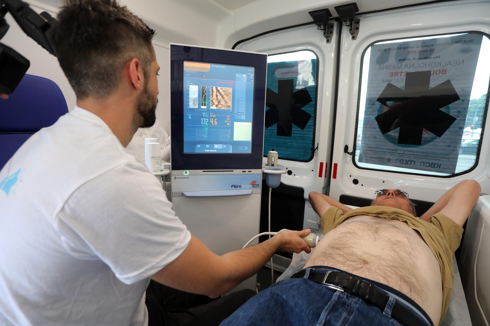 Rijeka: Povodom Svjetskog dana svjesnosti o nealkoholnoj masnoj bolesti jetre besplatno testiranje građana na Trgu 111. brigade HV Rijeka: Povodom Svjetskog dana svjesnosti o nealkoholnoj masnoj bolesti jetre besplatno testiranje građana na Trgu 111. brigade HV