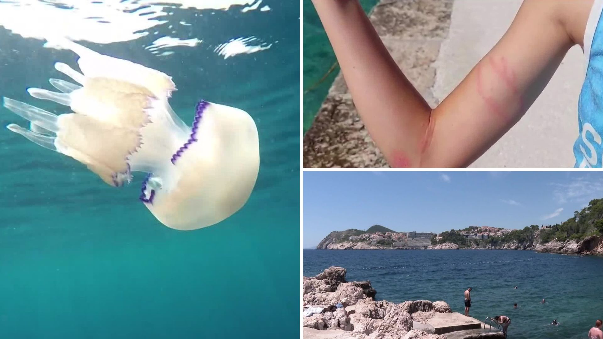 Najopasnije meduze Mediterana okupirale dio hrvatske obale: Opekotine ...