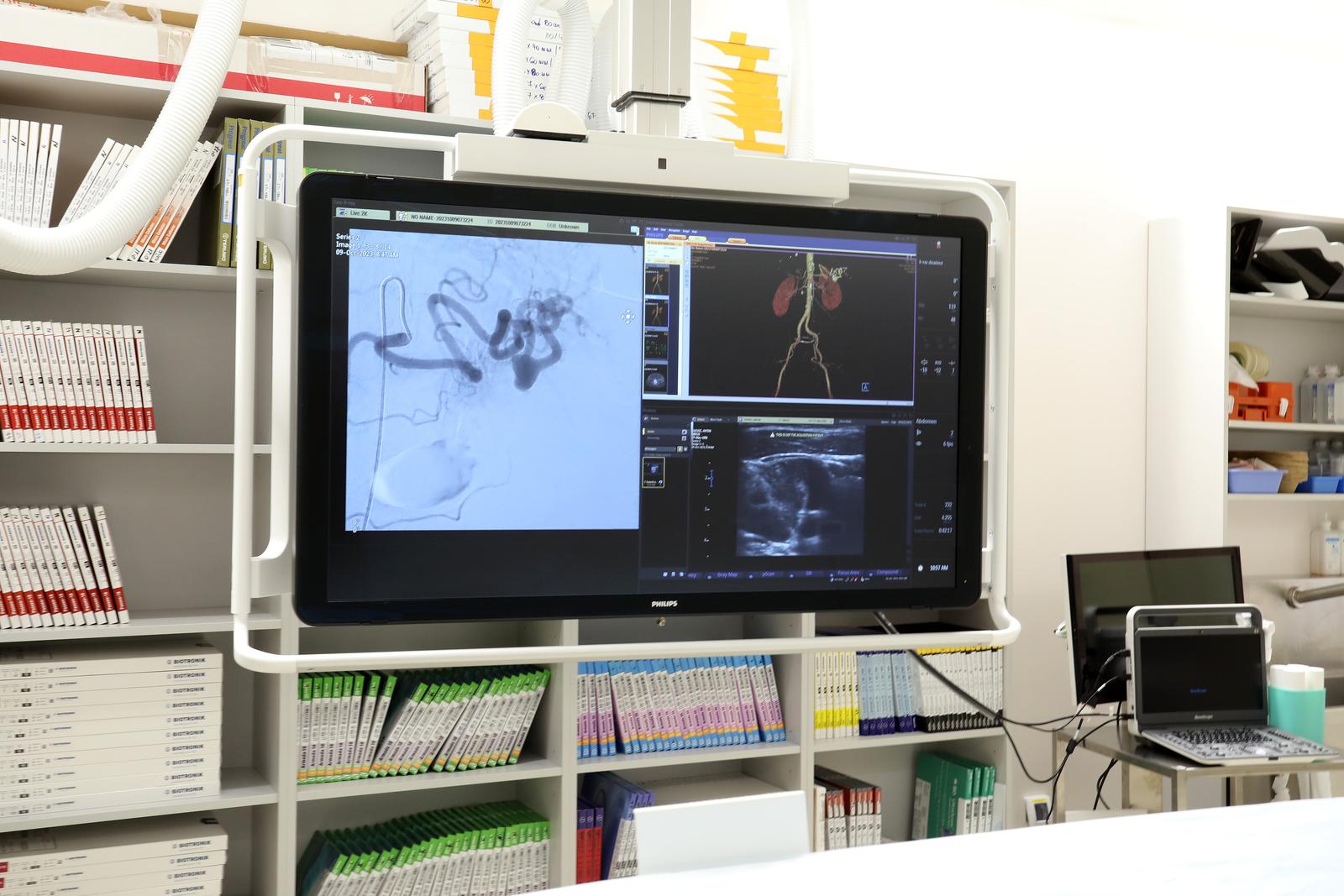 Ministar Vili Beroš u KBC-u Rijeka Ministar Vili Beroš u KBC-u Rijeka