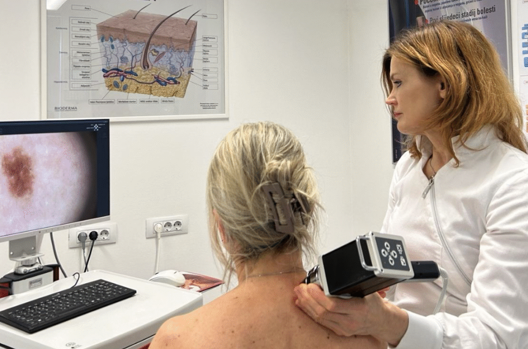 pregled madeža 222 pregled madeža 222